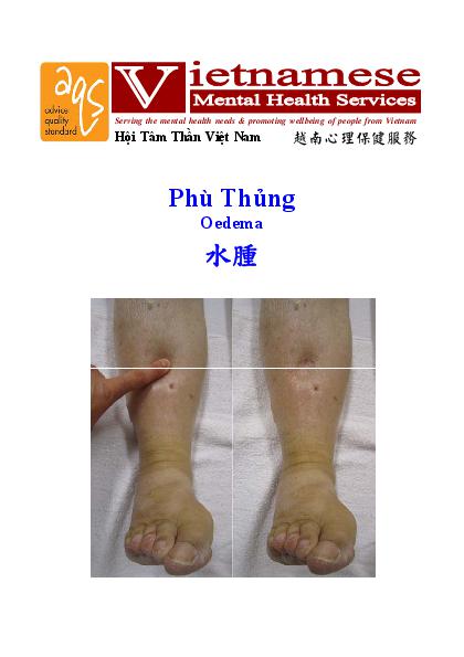 Oedema Vn