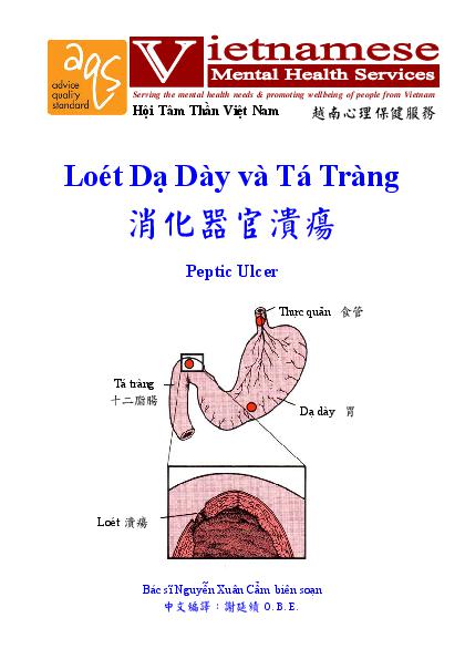 Peptic Ulcer Vn Cn